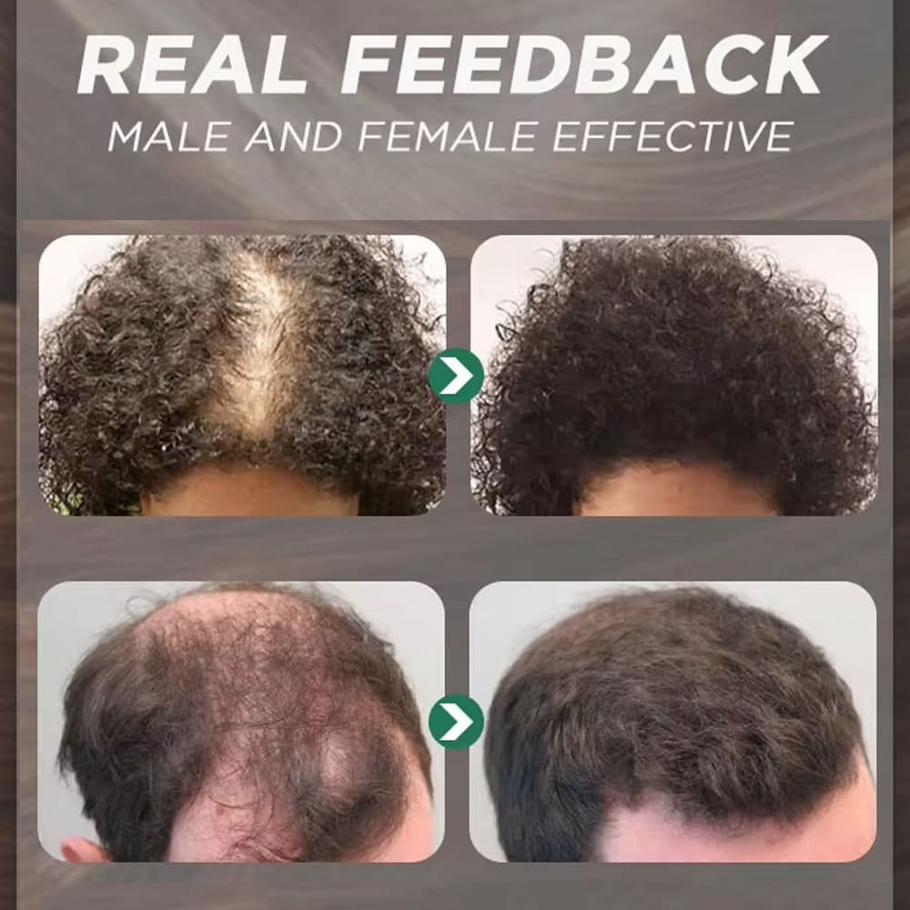 style tree caffeine anti hair loss shampoo – thinning hair & root strength
